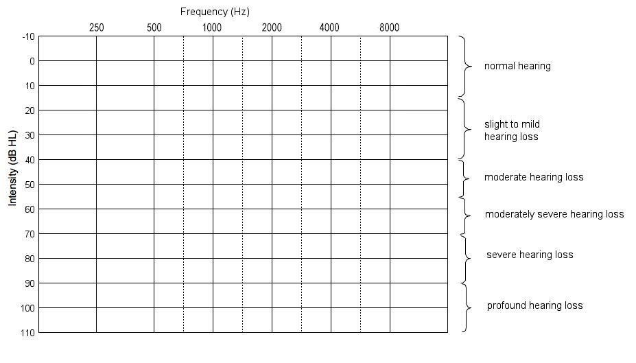 Hearing Aid Channels Animation